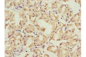 Immunohistochemistry (IHC) image for anti-Proteasome (Prosome, Macropain) 26S Subunit, Non-ATPase, 12 (PSMD12) (AA 197-456), (Regulatory Subunit 12) antibody (ABIN7142206)