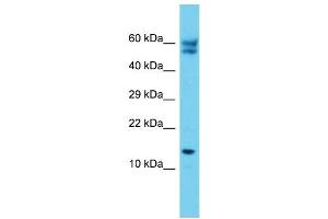 Host: Rabbit Target Name: C12orf65 Sample Type: Jurkat Whole Cell lysates Antibody Dilution: 1. (C12orf65 抗体  (C-Term))