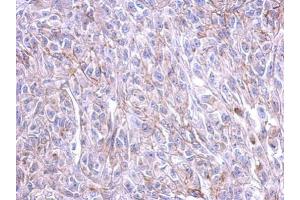 IHC-P Image Immunohistochemical analysis of paraffin-embedded HeLa xenograft, using CRFR1, antibody at 1:500 dilution. (CRHR1 抗体  (N-Term))