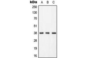 Western blot analysis of LAT (pY255) expression in HEK293T (A), Raw264. (LAT 抗体  (C-Term, pTyr255))