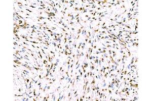 IHC analysis of Giantin/GOLGB1 using anti-Giantin/GOLGB1 antibody (ABIN7600139).