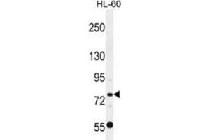 Western blot analysis in HL-60 cell line lysates (35ug/lane) detecting POU2F1 protein (arrow) by the use of POU2F1 (POU2F1 抗体  (Middle Region))