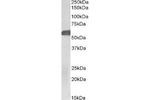 ABIN5539774 (1µg/ml) staining of Human Hippocampus lysate (35µg protein in RIPA buffer). (GLP1R 抗体  (Internal Region))