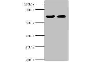 Western blot All lanes: CROT antibody at 3 μg/mL Lane 1: Mouse kidney tissue Lane 2: A431 whole cell lysate Secondary Goat polyclonal to rabbit IgG at 1/10000 dilution Predicted band size: 71, 11, 74 kDa Observed band size: 71 kDa (CROT 抗体  (AA 1-87))