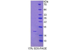SDS-PAGE analysis of Human NCR3 Protein. (NCR3 蛋白)