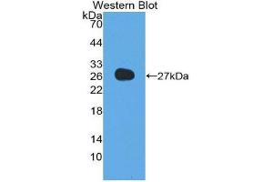Western Blotting (WB) image for anti-Adiponectin (ADIPOQ) (AA 32-244) antibody (ABIN1857925) (ADIPOQ 抗体  (AA 32-244))