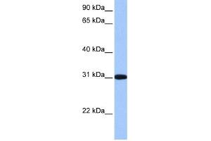 WB Suggested Anti-RFPL2 Antibody Titration: 0. (RFPL2 抗体  (C-Term))