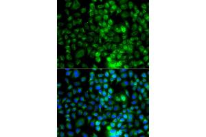 Immunofluorescence analysis of A549 cells using EPHA1 antibody (ABIN6290349). (EPHA1 抗体)