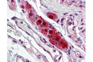 Anti-ELAVL4 / HuD antibody IHC of human small intestine, submucosal plexus.