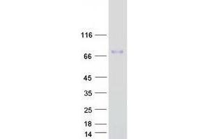 Western Blotting (WB) image for Collagen, Type VIII, alpha 2 (COL8A2) protein (Myc-DYKDDDDK Tag) (ABIN2712429)