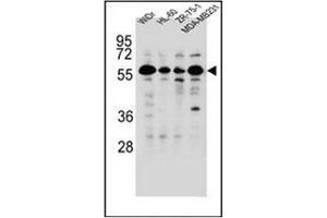 Western blot analysis of FOXC2 Antibody  in WiDr,HL-60,ZR-75-1,MDA-MB231 cell line lysates (35ug/lane). (FOXC2 抗体  (Middle Region))