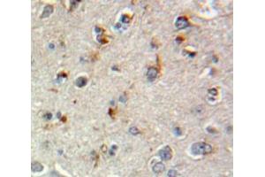 Used in DAB staining on fromalin fixed paraffin-embedded Brain tissue (SCG2 抗体  (AA 11-187))