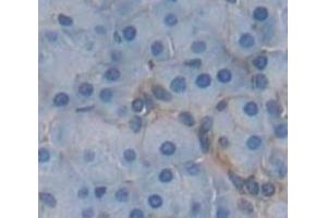 IHC-P analysis of Human Tissue, with DAB staining. (HLA-E 抗体  (AA 136-350))