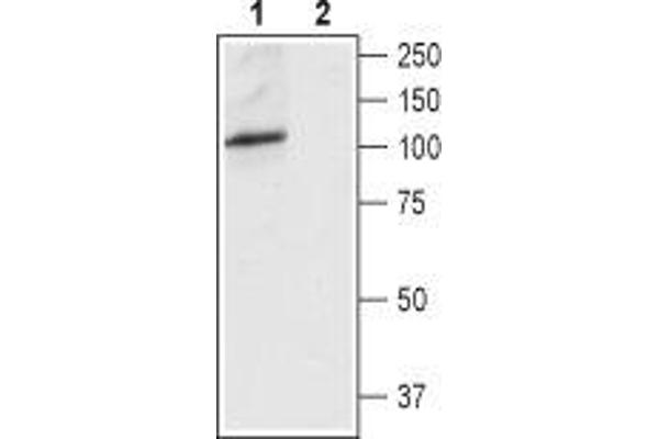 TRPV4 抗体  (3rd Extracellular Loop)