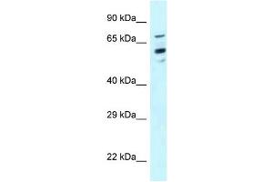 Western Blot showing TOMM70A antibody used at a concentration of 1 ug/ml against Hela Cell Lysate (TOM70 抗体  (N-Term))