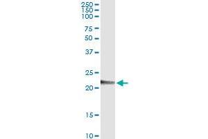 Immunoprecipitation of PMVK transfected lysate using anti-PMVK MaxPab rabbit polyclonal antibody and Protein A Magnetic Bead , and immunoblotted with PMVK purified MaxPab mouse polyclonal antibody (B01P) . (PMVK 抗体  (AA 1-192))