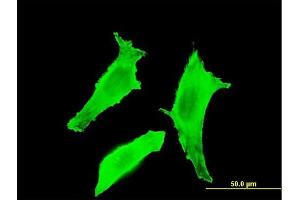 Immunofluorescence of monoclonal antibody to BTLA on HeLa cell. (BTLA 抗体  (AA 190-289))