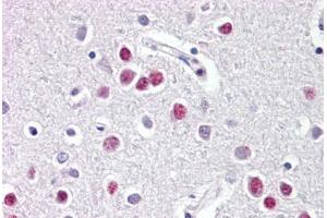 Image no. 2 for anti-Nuclear Receptor Subfamily 1, Group D, Member 1 (NR1D1) (AA 290-339) antibody (ABIN6749732) (NR1D1 抗体  (AA 290-339))