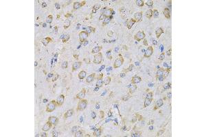 Immunohistochemistry of paraffin-embedded rat brain using IL10RA Antibody (ABIN5970931) at dilution of 1/100 (40x lens). (IL-10RA 抗体)