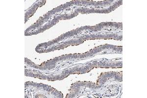 Immunohistochemical staining of human fallopian tube with LACE1 polyclonal antibody  shows strong positivity in ciliated cells. (LACE1 抗体)