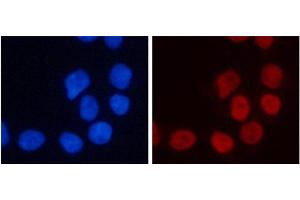 Immunofluorescence analysis of 293T cells using TriMethyl-Histone H3-K4 Polyclonal Antibody