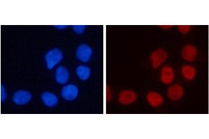 Immunofluorescence analysis of 293T cells using TriMethyl-Histone H3-K4 Polyclonal Antibody (Histone 3 抗体  (3meLys4))