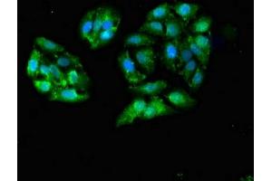 Immunofluorescent analysis of HepG2 cells using ABIN7153418 at dilution of 1:100 and Alexa Fluor 488-congugated AffiniPure Goat Anti-Rabbit IgG(H+L) (GALK1 抗体  (AA 23-164))