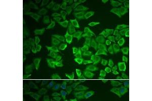 Immunofluorescence analysis of HeLa cells using CRHBP Polyclonal Antibody (CRHBP 抗体)