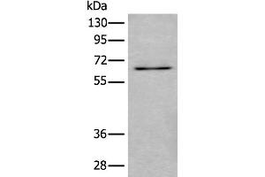 Western blot analysis of SKOV3 cell lysate using UBQLN2 Polyclonal Antibody at dilution of 1:500 (Ubiquilin 2 抗体)