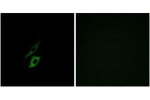 Immunofluorescence analysis of A549 cells, using FPR1 Antibody. (FPR1 抗体  (AA 151-200))