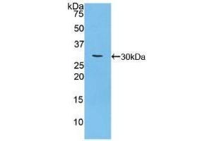 Detection of Recombinant CA125, Mouse using Polyclonal Antibody to Carbohydrate Antigen 125 (CA125) (MUC16 抗体  (AA 2-258))