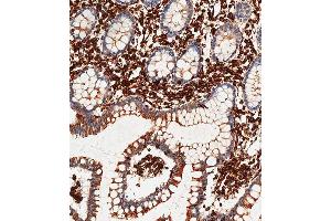 Immunohistochemical analysis of paraffin-embedded Human small intestine tissue using A performed on the Leica® BOND RXm. (Vimentin 抗体)
