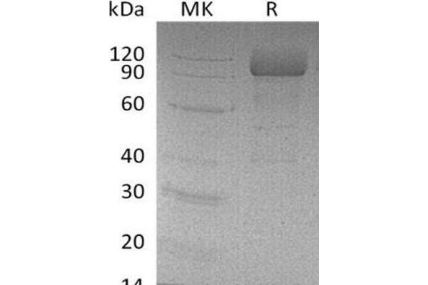 SCARB2 Protein (His tag)
