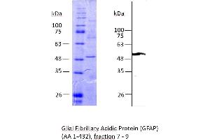 Image no. 2 for Glial Fibrillary Acidic Protein (GFAP) (AA 1-432) protein (Strep Tag) (ABIN3096575) (GFAP Protein (AA 1-432) (Strep Tag))
