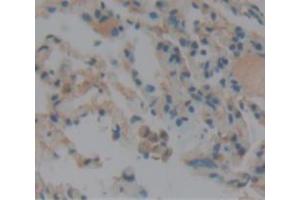 Used in DAB staining on fromalin fixed paraffin- embedded lung tissue (CNN2 抗体  (AA 1-269))