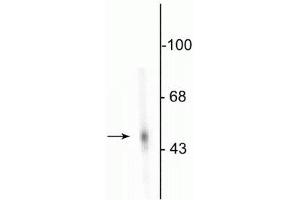 Western blot of rat adrenal medulla showing specific immunolabeling of the ~55 kDa DDC protein. (DDC 抗体)