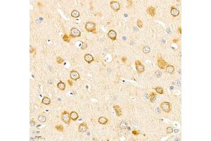 Immunohistochemistry of paraffin embedded rat brain using IP3R1 (ABIN7074293) at dilution of 1: 2400 (400x lens) (IP3 Receptor 抗体)