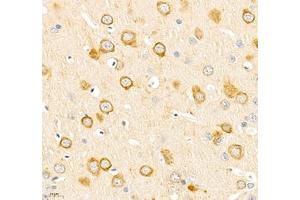 Immunohistochemistry of paraffin embedded rat brain using IP3R1 (ABIN7074293) at dilution of 1: 2400 (400x lens)