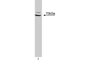 Western Blotting (WB) image for anti-zeta-Chain (TCR) Associated Protein Kinase 70kDa (ZAP70) (AA 468-619) antibody (ABIN967849) (ZAP70 抗体  (AA 468-619))