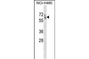 Western blot analysis in NCI-H460 cell line lysates (35ug/lane). (CYP4V2 抗体  (C-Term))