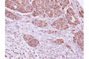 IHC-P Image Immunohistochemical analysis of paraffin-embedded NCIN87 xenograft, using DUSP7 , antibody at 1:100 dilution. (DUSP7 抗体  (C-Term))