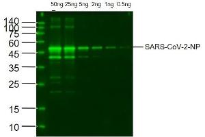 SARS-CoV-2 Nucleocapsid Protein at 0. (SARS-CoV-2 Nucleocapsid 抗体)