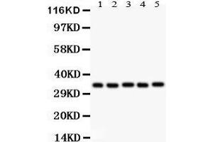 Western Blotting (WB) image for anti-Homeobox A11 (HOXA11) (AA 74-245) antibody (ABIN3042454) (Homeobox A11 抗体  (AA 74-245))