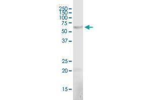 CRAT polyclonal antibody (A01). (CRAT 抗体  (AA 445-544))