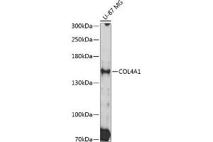 Western blot analysis of extracts of U-87 MG cells, using COL4 Antibody (0710) at 1:3000 dilution. (COL4A1 抗体  (AA 1445-1669))