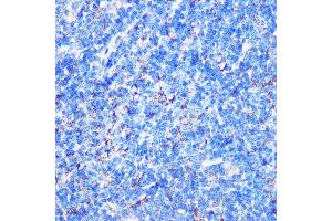 Immunohistochemistry of paraffin-embedded Mouse spleen using STK26 Rabbit pAb (ABIN7270231) at dilution of 1:100 (40x lens). (STK26/MST4 抗体  (AA 297-416))