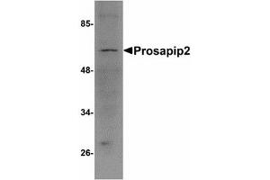 Image no. 1 for anti-TBK1 Binding Protein 1 (TBKBP1) (C-Term) antibody (ABIN478165) (TBKBP1 抗体  (C-Term))