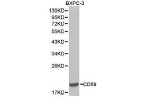 Western Blotting (WB) image for anti-CD59 (CD59) antibody (ABIN1871644) (CD59 抗体)