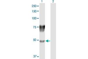 Western Blot analysis of SERPIND1 expression in transfected 293T cell line by SERPIND1 MaxPab polyclonal antibody. (SERPIND1 抗体  (AA 1-499))