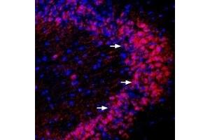 Immunohistochemistry (IHC) image for anti-Protein Interacting With Protein Kinase C, alpha 1 (PICK1) (AA 305-318), (Intracellular) antibody (ABIN7043566)